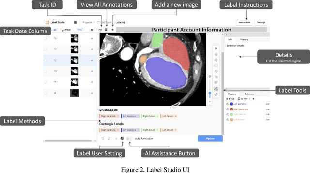 Figure 3 for Coupling AI and Citizen Science in Creation of Enhanced Training Dataset for Medical Image Segmentation