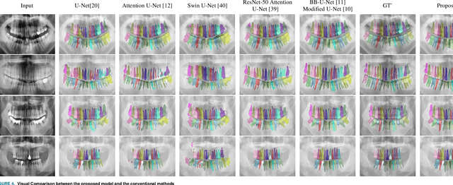 Figure 4 for Multiclass Segmentation using Teeth Attention Modules for Dental X-ray Images