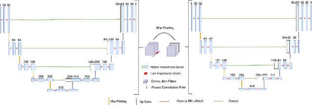Figure 1 for Neural Network Pruning for Real-time Polyp Segmentation