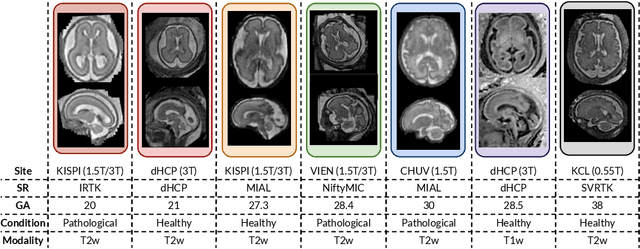 Figure 1 for Maximizing domain generalization in fetal brain tissue segmentation: the role of synthetic data generation, intensity clustering and real image fine-tuning