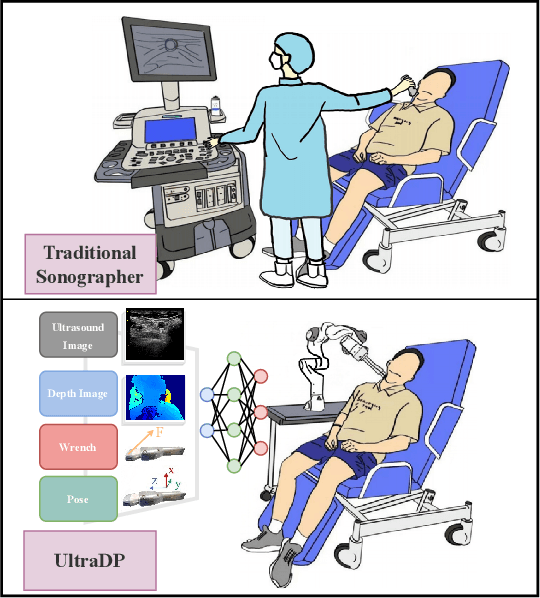 Figure 1 for UltraDP: Generalizable Carotid Ultrasound Scanning with Force-Aware Diffusion Policy
