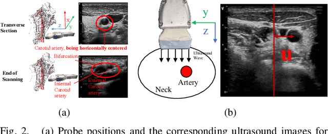 Figure 2 for UltraDP: Generalizable Carotid Ultrasound Scanning with Force-Aware Diffusion Policy