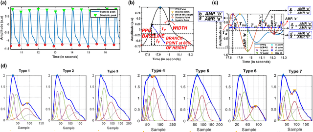 Figure 2 for Schrödinger Spectrum based Continuous Cuff-less Blood Pressure Estimation using Clinically Relevant Features from PPG Signal and its Second Derivative