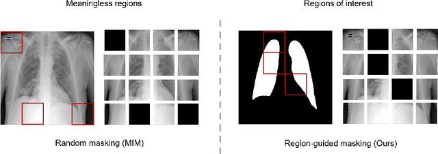 Figure 1 for RGMIM: Region-Guided Masked Image Modeling for COVID-19 Detection