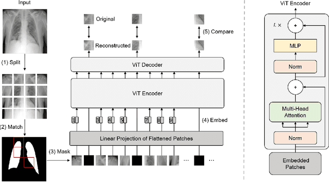 Figure 3 for RGMIM: Region-Guided Masked Image Modeling for COVID-19 Detection