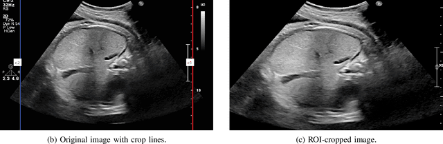 Figure 2 for Uterine Ultrasound Image Captioning Using Deep Learning Techniques