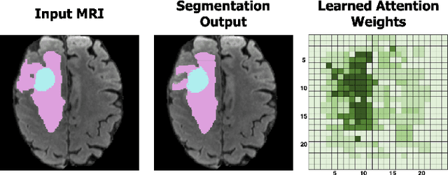 Figure 1 for Self-Supervised Modality-Agnostic Pre-Training of Swin Transformers