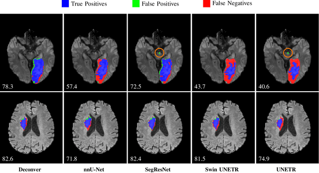 Figure 4 for Deconver: A Deconvolutional Network for Medical Image Segmentation