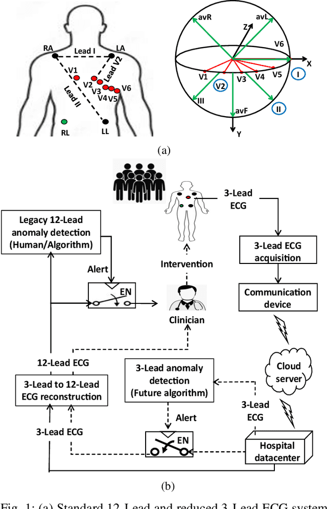 Figure 1 for AI-based 3-Lead to 12-Lead ECG Reconstruction: Towards Smartphone-based Public Healthcare