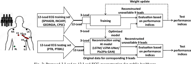 Figure 2 for AI-based 3-Lead to 12-Lead ECG Reconstruction: Towards Smartphone-based Public Healthcare