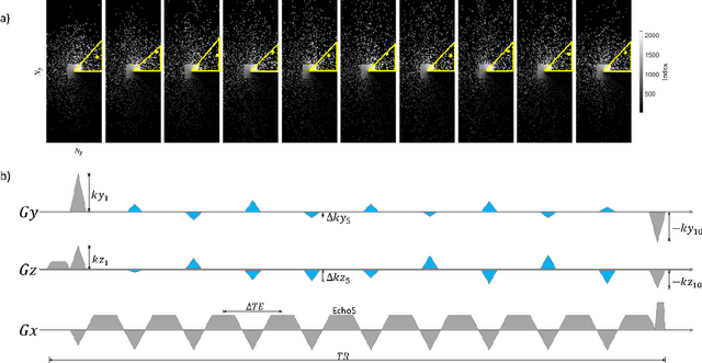 Figure 2 for LARO: Learned Acquisition and Reconstruction Optimization to accelerate Quantitative Susceptibility Mapping