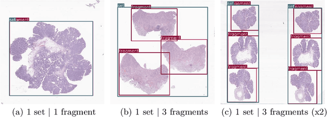 Figure 3 for CountPath: Automating Fragment Counting in Digital Pathology