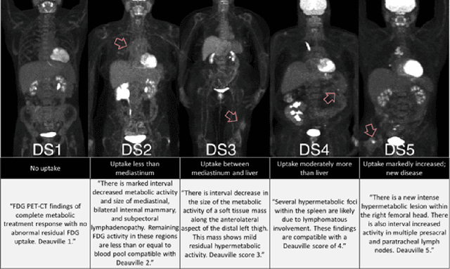 Figure 1 for Domain-adapted large language models for classifying nuclear medicine reports