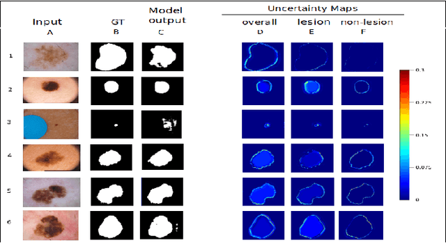Figure 4 for Uncertainty Quantified Deep Learning and Regression Analysis Framework for Image Segmentation of Skin Cancer Lesions