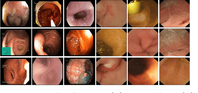 Figure 3 for Classification of Endoscopy and Video Capsule Images using CNN-Transformer Model