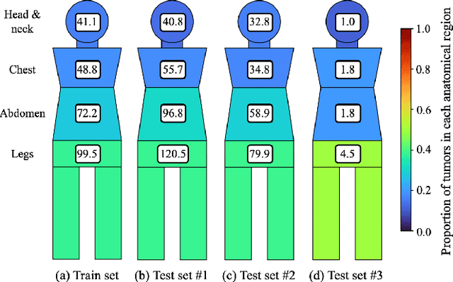 Figure 4 for Anatomy-Informed Deep Learning and Radiomics for Automated Neurofibroma Segmentation in Whole-Body MRI
