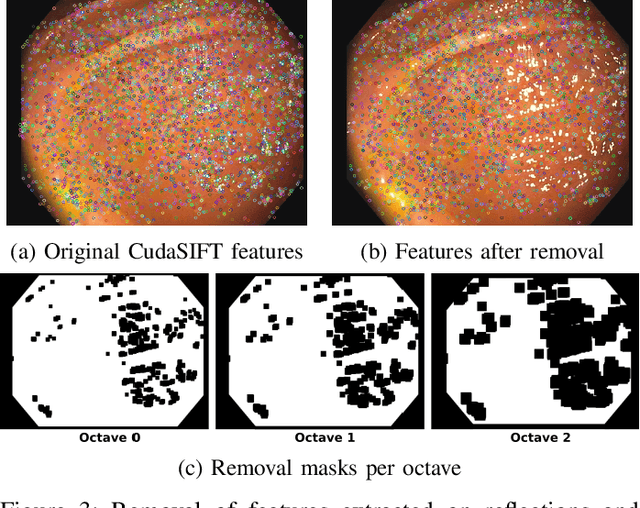 Figure 4 for CudaSIFT-SLAM: multiple-map visual SLAM for full procedure mapping in real human endoscopy