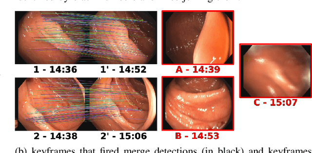 Figure 2 for CudaSIFT-SLAM: multiple-map visual SLAM for full procedure mapping in real human endoscopy