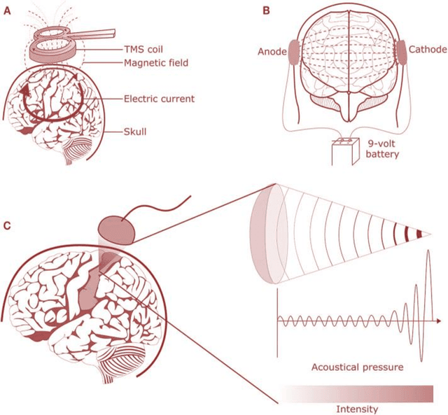 Figure 2 for IoMT-Blockchain based Secured Remote Patient Monitoring Framework for Neuro-Stimulation Device