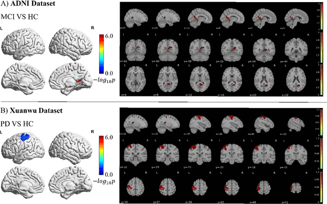 Figure 4 for Multi-modal Dynamic Graph Network: Coupling Structural and Functional Connectome for Disease Diagnosis and Classification