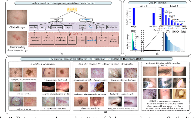 Figure 3 for Revamping AI Models in Dermatology: Overcoming Critical Challenges for Enhanced Skin Lesion Diagnosis