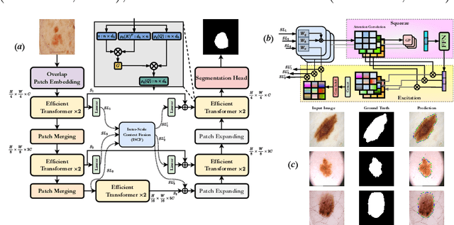 Figure 1 for Inter-Scale Dependency Modeling for Skin Lesion Segmentation with Transformer-based Networks