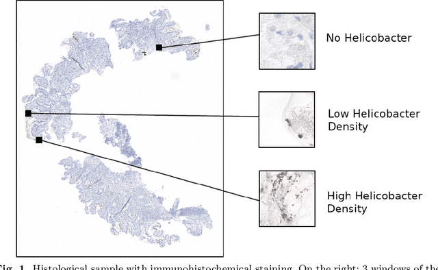 Figure 1 for Diagnosising Helicobacter pylori using AutoEncoders and Limited Annotations through Anomalous Staining Patterns in IHC Whole Slide Images
