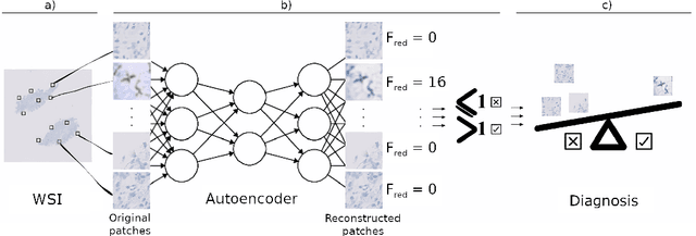 Figure 3 for Diagnosising Helicobacter pylori using AutoEncoders and Limited Annotations through Anomalous Staining Patterns in IHC Whole Slide Images