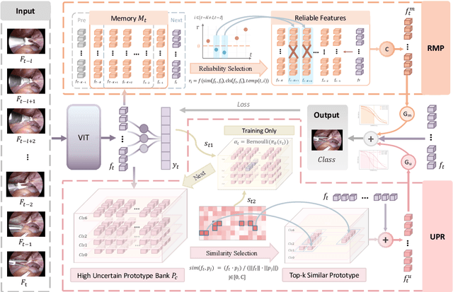 Figure 3 for DSTED: Decoupling Temporal Stabilization and Discriminative Enhancement for Surgical Workflow Recognition