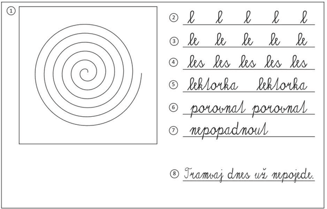 Figure 1 for Evaluation of handwriting kinematics and pressure for differential diagnosis of Parkinson's disease