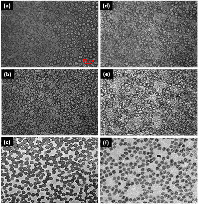 Figure 4 for Deep Learning-Enhanced Analysis for Delineating Anticoagulant Essay Efficacy Using Phase Microscopy