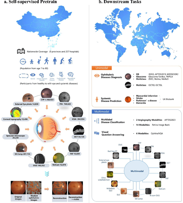 Figure 1 for EyeFound: A Multimodal Generalist Foundation Model for Ophthalmic Imaging