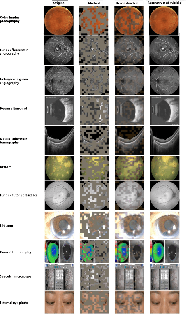 Figure 3 for EyeFound: A Multimodal Generalist Foundation Model for Ophthalmic Imaging