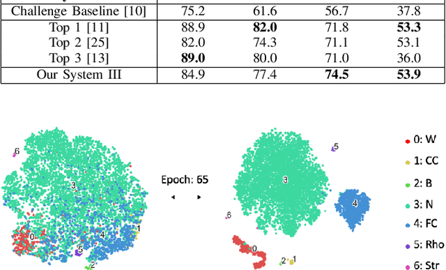 Figure 3 for An Inception-Residual-Based Architecture with Multi-Objective Loss for Detecting Respiratory Anomalies