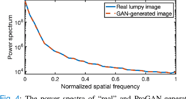 Figure 4 for Ideal Observer Computation by Use of Markov-Chain Monte Carlo with Generative Adversarial Networks