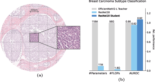 Figure 1 for Fine-tuning a Multiple Instance Learning Feature Extractor with Masked Context Modelling and Knowledge Distillation