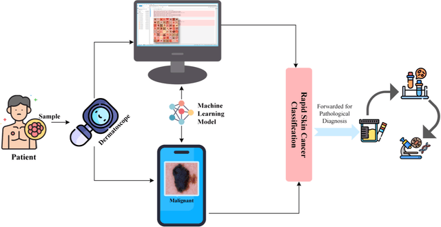 Figure 2 for Skin Cancer Segmentation and Classification Using Vision Transformer for Automatic Analysis in Dermatoscopy-based Non-invasive Digital System
