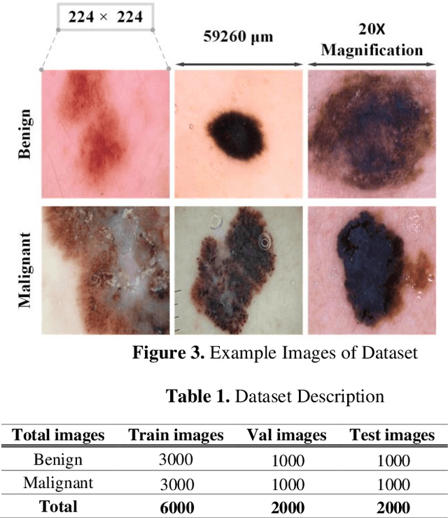 Figure 4 for Skin Cancer Segmentation and Classification Using Vision Transformer for Automatic Analysis in Dermatoscopy-based Non-invasive Digital System