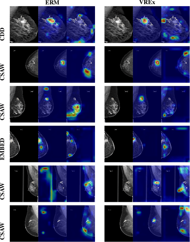 Figure 1 for Revisiting Invariant Learning for Out-of-Domain Generalization on Multi-Site Mammogram Datasets