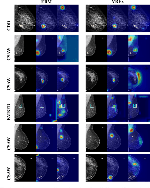 Figure 3 for Revisiting Invariant Learning for Out-of-Domain Generalization on Multi-Site Mammogram Datasets