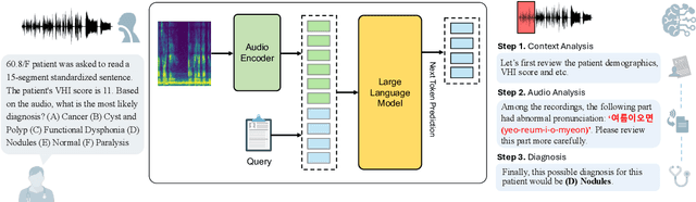 Figure 1 for VocalAgent: Large Language Models for Vocal Health Diagnostics with Safety-Aware Evaluation