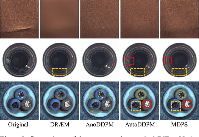 Figure 2 for Unsupervised Anomaly Detection via Masked Diffusion Posterior Sampling