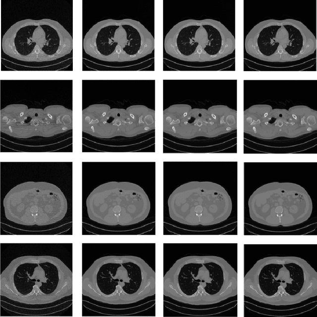Figure 3 for AST-n: A Fast Sampling Approach for Low-Dose CT Reconstruction using Diffusion Models