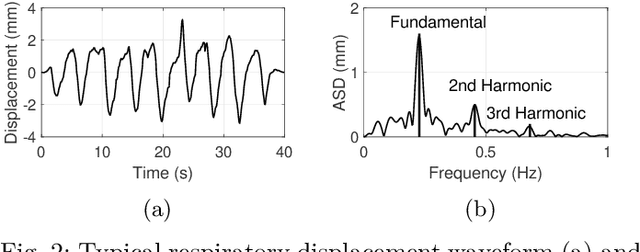 Figure 2 for Radar-Based Estimation of Human Body Orientation Using Respiratory Features and Hierarchical Regression Model