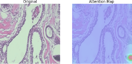 Figure 2 for ViT-DeiT: An Ensemble Model for Breast Cancer Histopathological Images Classification
