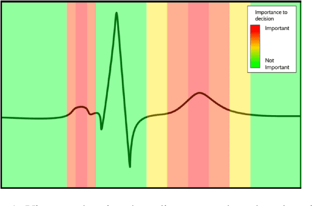 Figure 2 for Explainable AI (XAI) for Arrhythmia detection from electrocardiograms