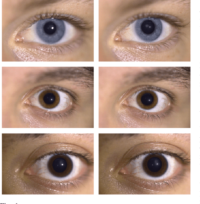 Figure 1 for Smartphone-based Iris Recognition through High-Quality Visible Spectrum Iris Capture