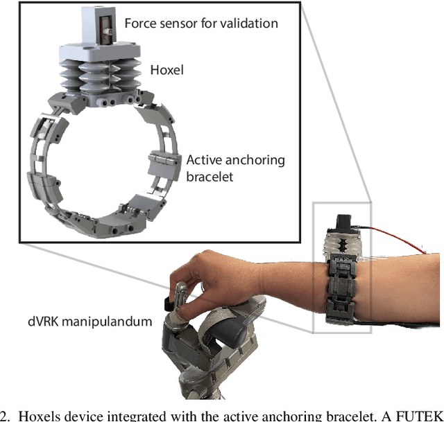 Figure 2 for Effects of Wrist-Worn Haptic Feedback on Force Accuracy and Task Speed during a Teleoperated Robotic Surgery Task