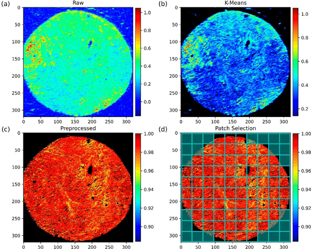 Figure 3 for Dual-path convolutional neural network using micro-FTIR imaging to predict breast cancer subtypes and biomarkers levels: estrogen receptor, progesterone receptor, HER2 and Ki67