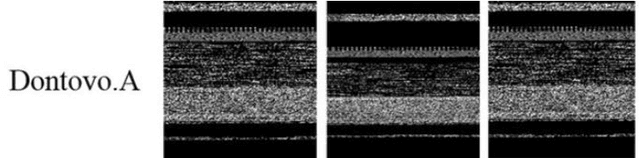 Figure 4 for New Approach to Malware Detection Using Optimized Convolutional Neural Network